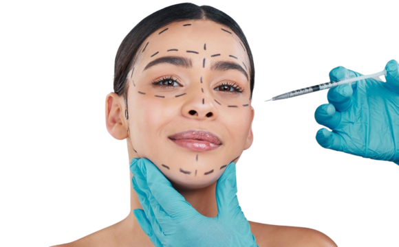 Rinoplastica - esterna Rinoplastica