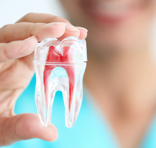 TRATTAMENTO DEL CANALE RADICE RCT