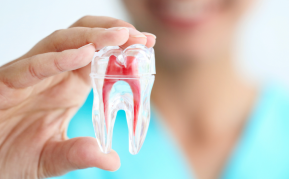 Trattamento del canale radice TRATTAMENTO DEL CANALE RADICE RCT