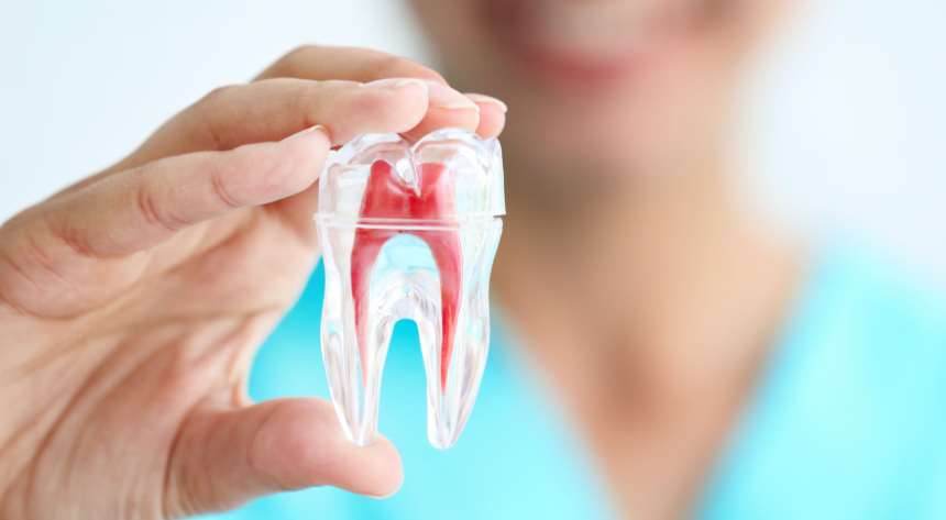 TRATTAMENTO DEL CANALE RADICE RCT